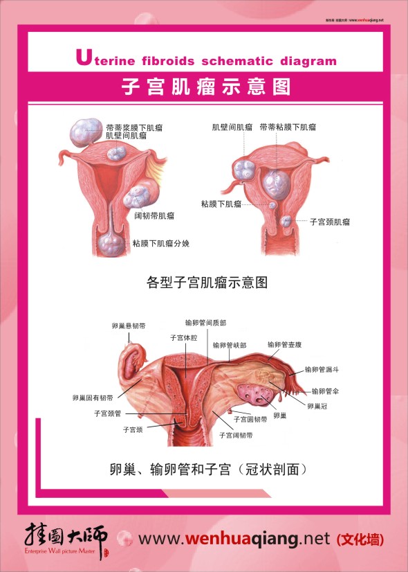 人體結構解剖圖   人體結構圖   人體結構示意圖   子宮肌瘤示意圖     